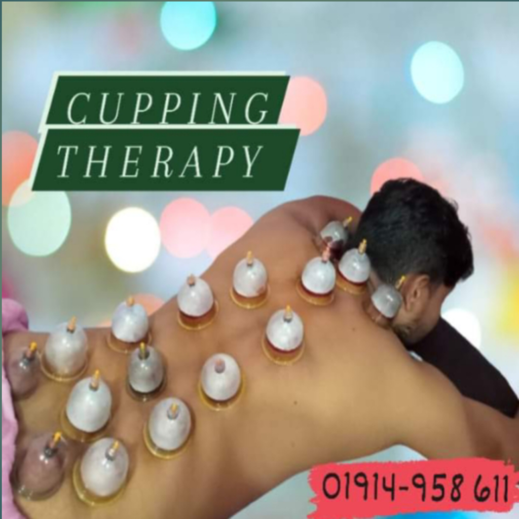 Cupping Therapy Hijama Therapy