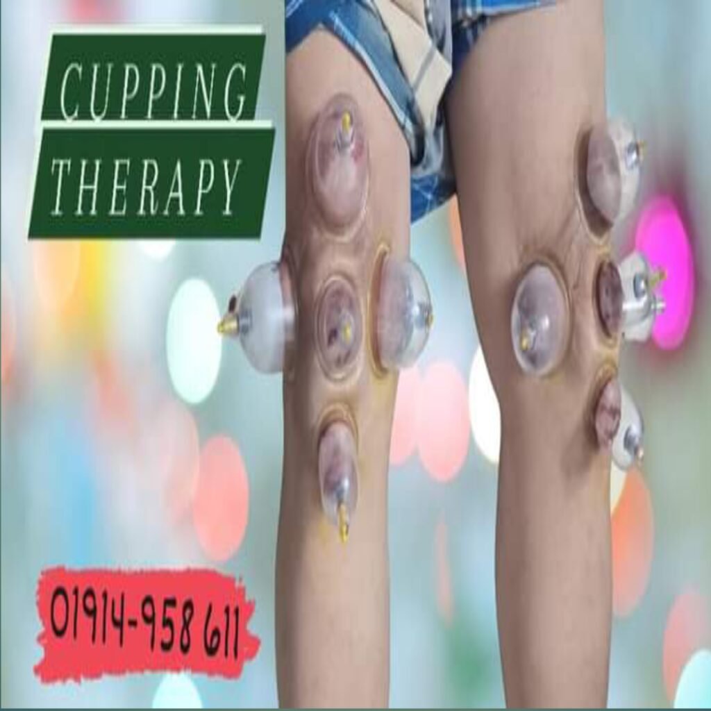 Cupping Therapy hijama Therapy