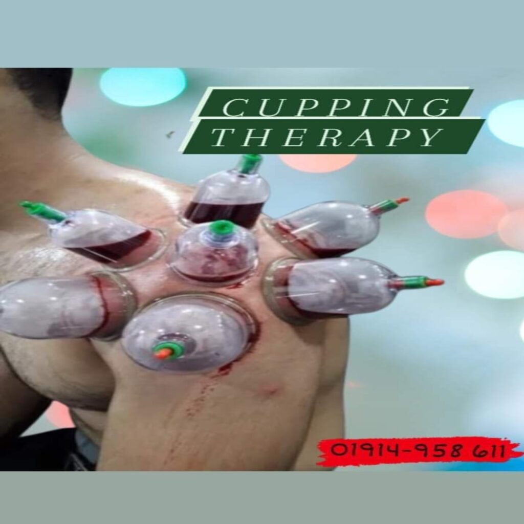 Cupping Therapy Hijama therapy Cup Therapy What is Hijama HIjama Cupping Hijama Benifit HIjama Photo